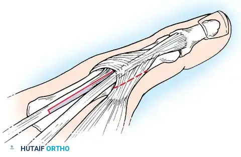 Hutaifortho's Orthopaedic Diagram