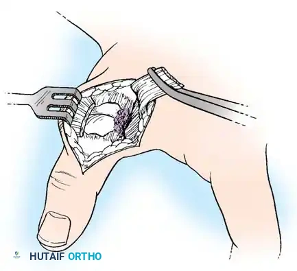 Hutaifortho's Orthopaedic Diagram