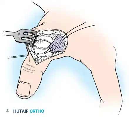 Hutaifortho's Orthopaedic Diagram