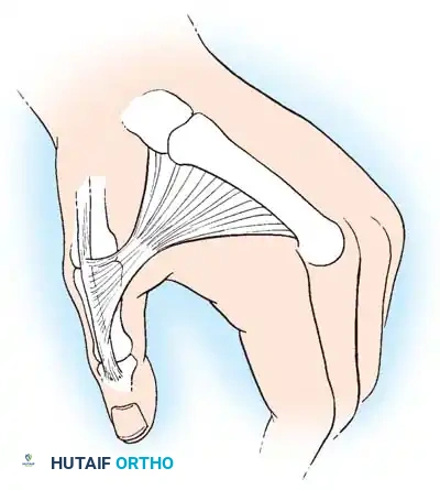 Hutaifortho's Orthopaedic Diagram