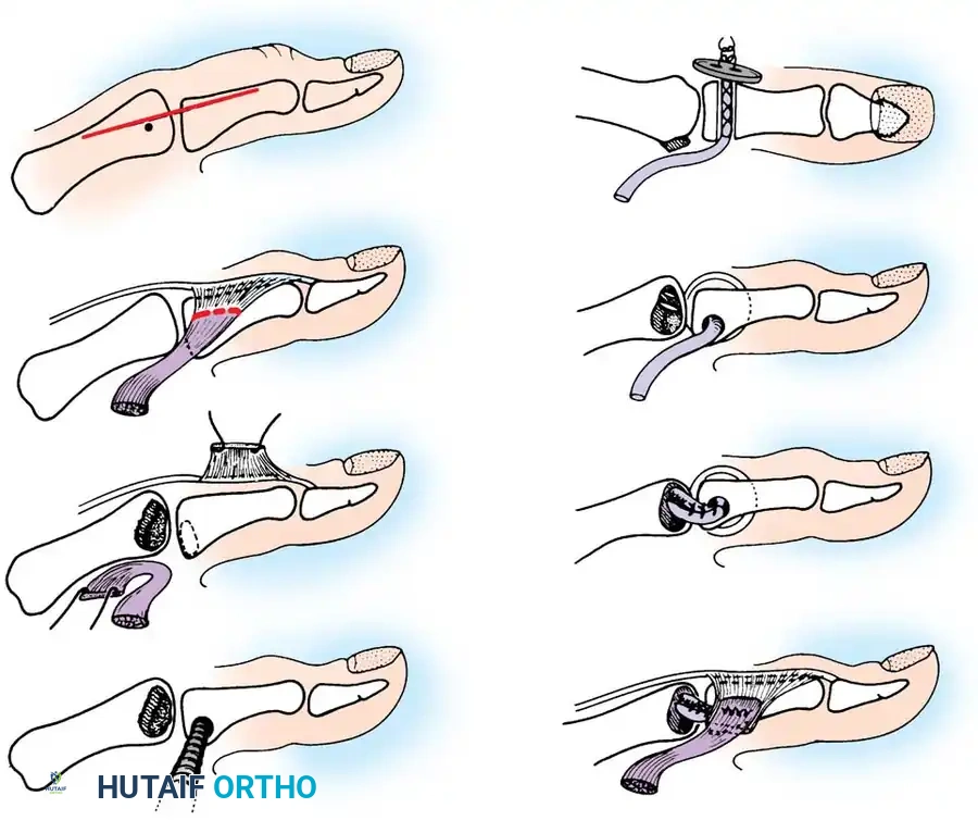 Hutaifortho's Orthopaedic Diagram