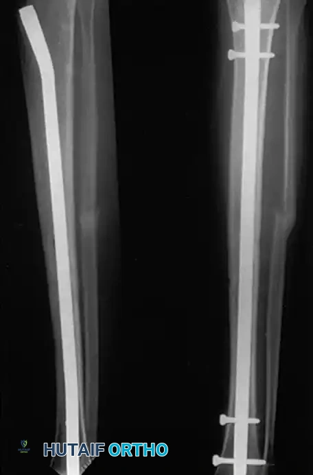 Hutaifortho's Orthopaedic Diagram