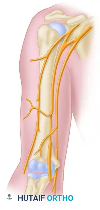 TRANSFER OF THE ULNAR NERVE FASCICLES TO NERVE OF THE BICEPS MUSCLE Surgical Diagram