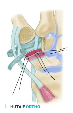 Hutaifortho's Orthopaedic Diagram