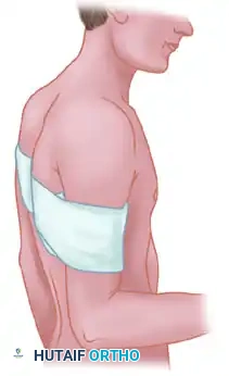 TREATMENT Surgical Diagram