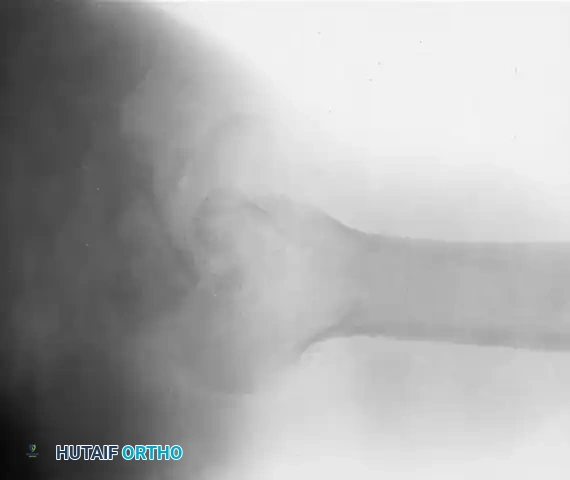 TREATMENT Surgical Diagram