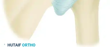 TREATMENT Surgical Diagram