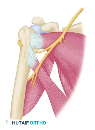 TREATMENT Surgical Diagram