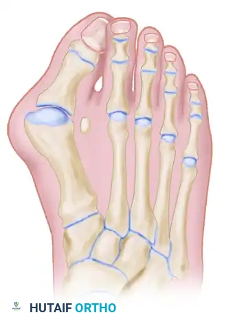 TREATMENT Surgical Diagram