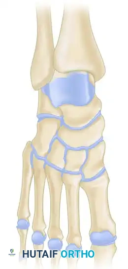 صورة توضيحية لنتائج المسح الذري المتقدم للقدم