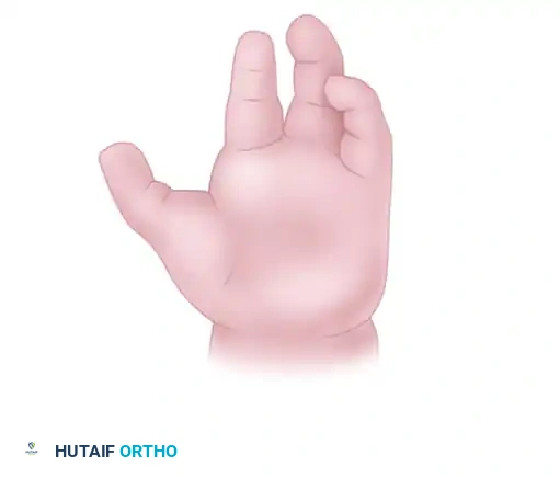 Manske and Halikis Web Types