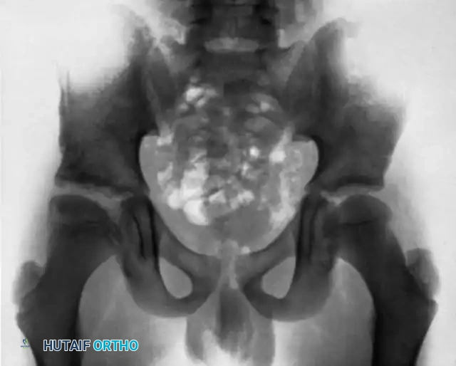 Hutaifortho's Orthopaedic Diagram