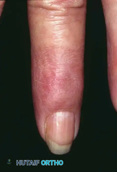 Hutaifortho's Orthopaedic Diagram