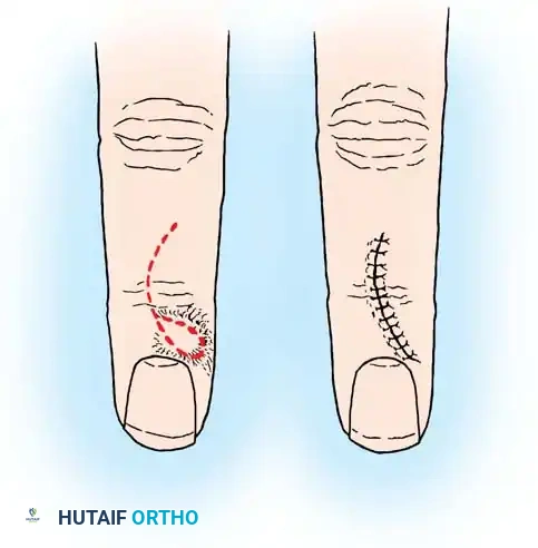 Hutaifortho's Orthopaedic Diagram