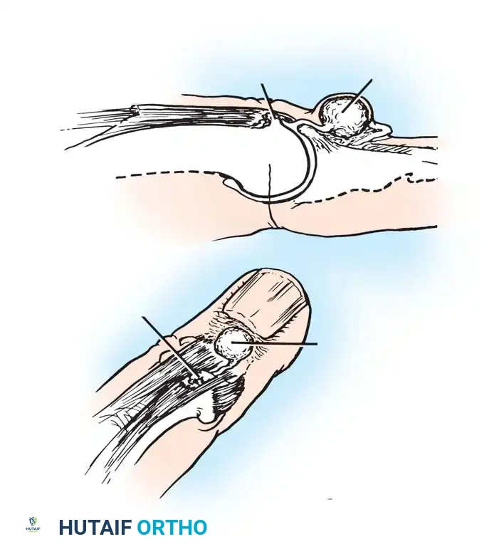 Hutaifortho's Orthopaedic Diagram