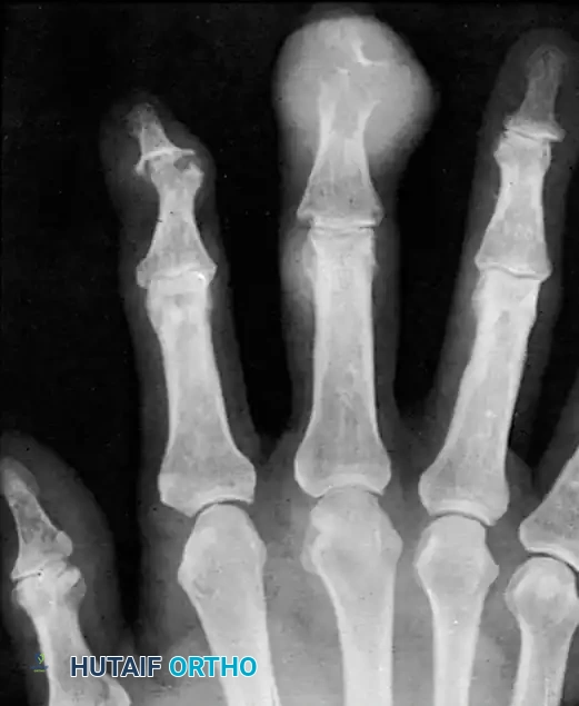 Hutaifortho's Orthopaedic Diagram