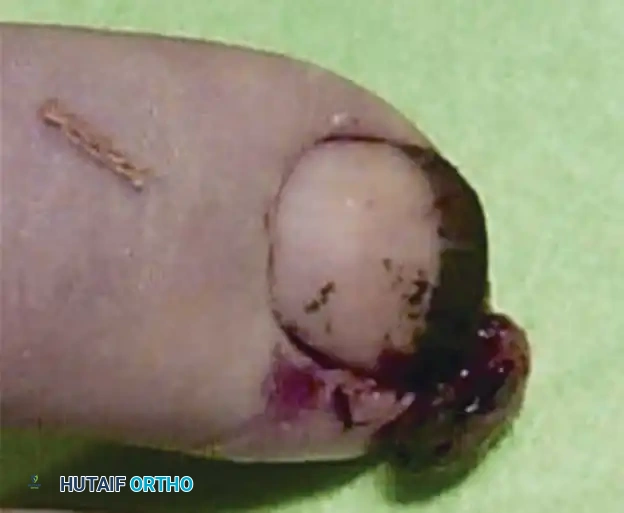 Hutaifortho's Orthopaedic Diagram