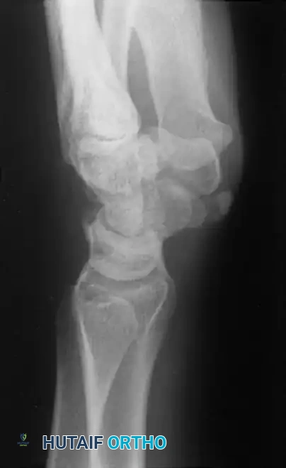 Hutaifortho's Orthopaedic Diagram