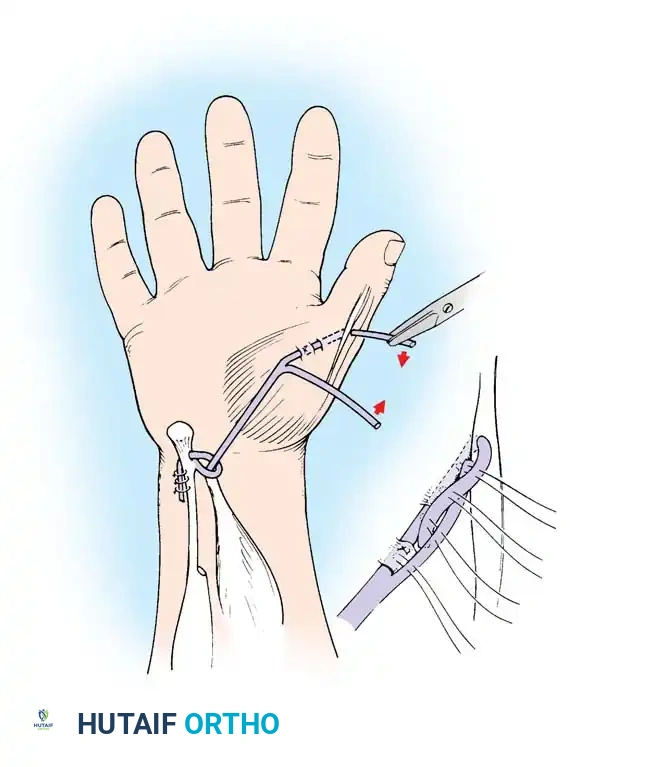 Hutaifortho's Orthopaedic Diagram