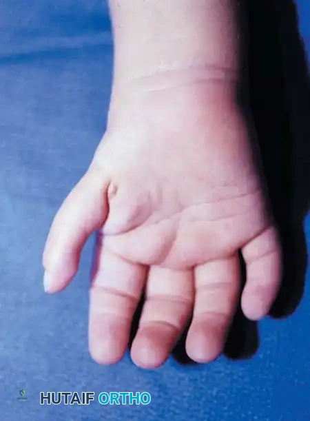 Hutaifortho's Orthopaedic Diagram