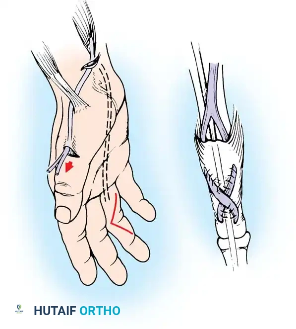 Hutaifortho's Orthopaedic Diagram