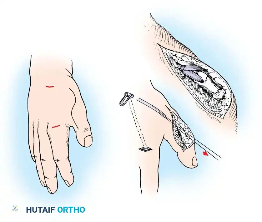 Hutaifortho's Orthopaedic Diagram