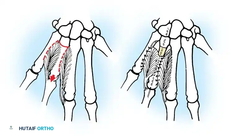 Hutaifortho's Orthopaedic Diagram