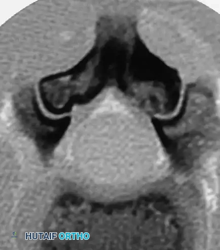 Hutaifortho's Orthopaedic Diagram