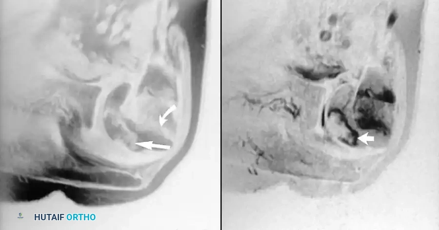WRIST AND ELBOW Surgical Diagram