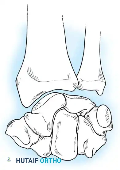 Operative Orthopaedics: Comprehensive Surgical Anatomy and Biomechanics of the Wrist