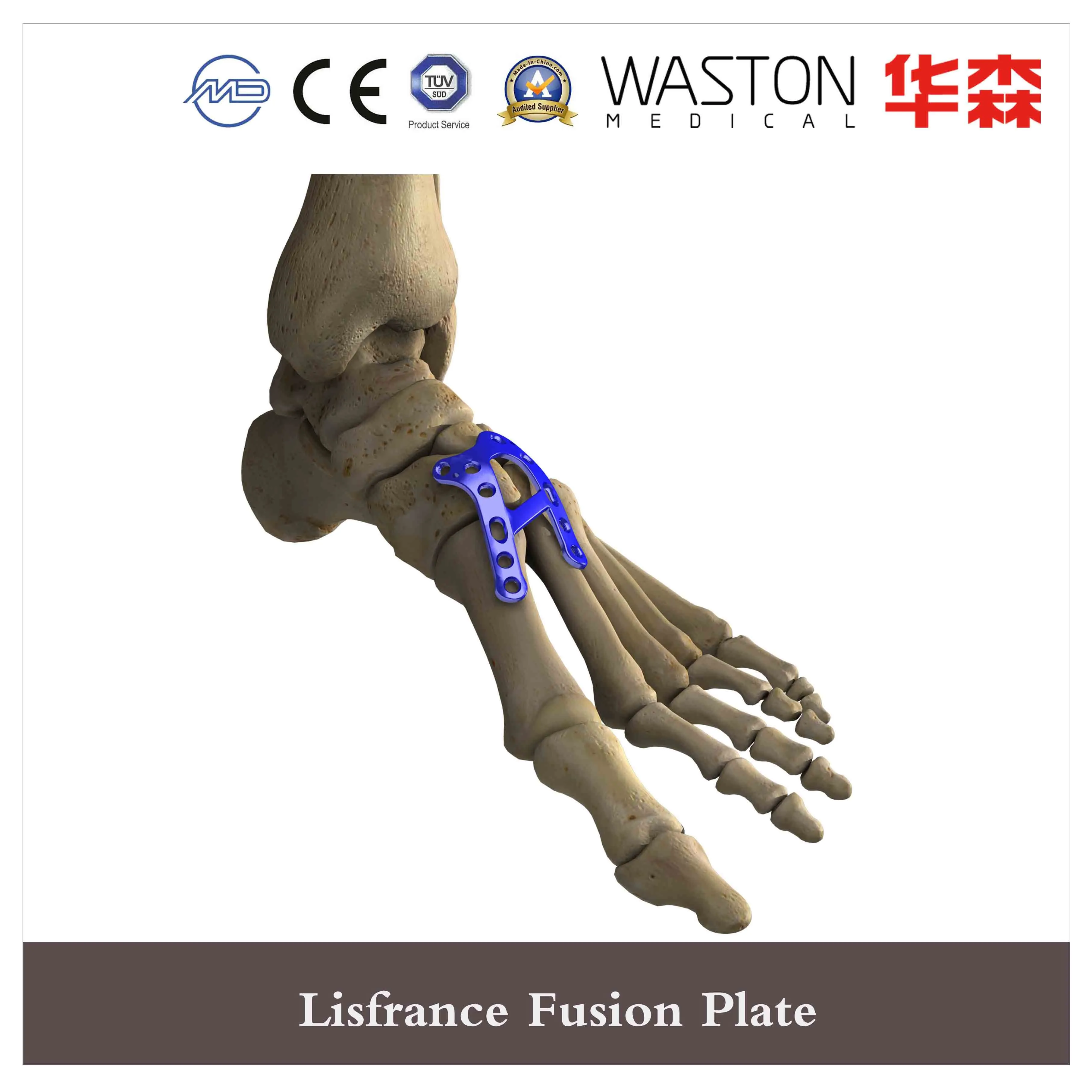 Lisfranc Midfoot Plating System