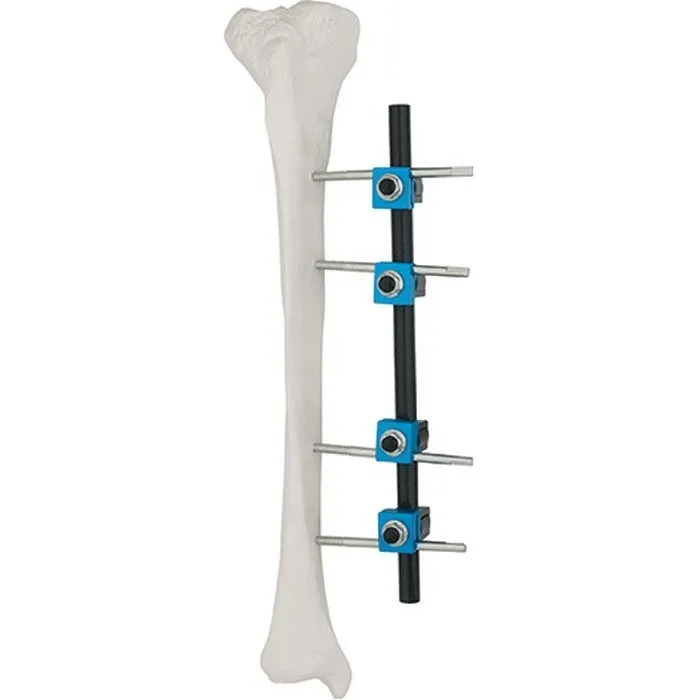 Tibial Inlay Graft Fixation (ACL)
