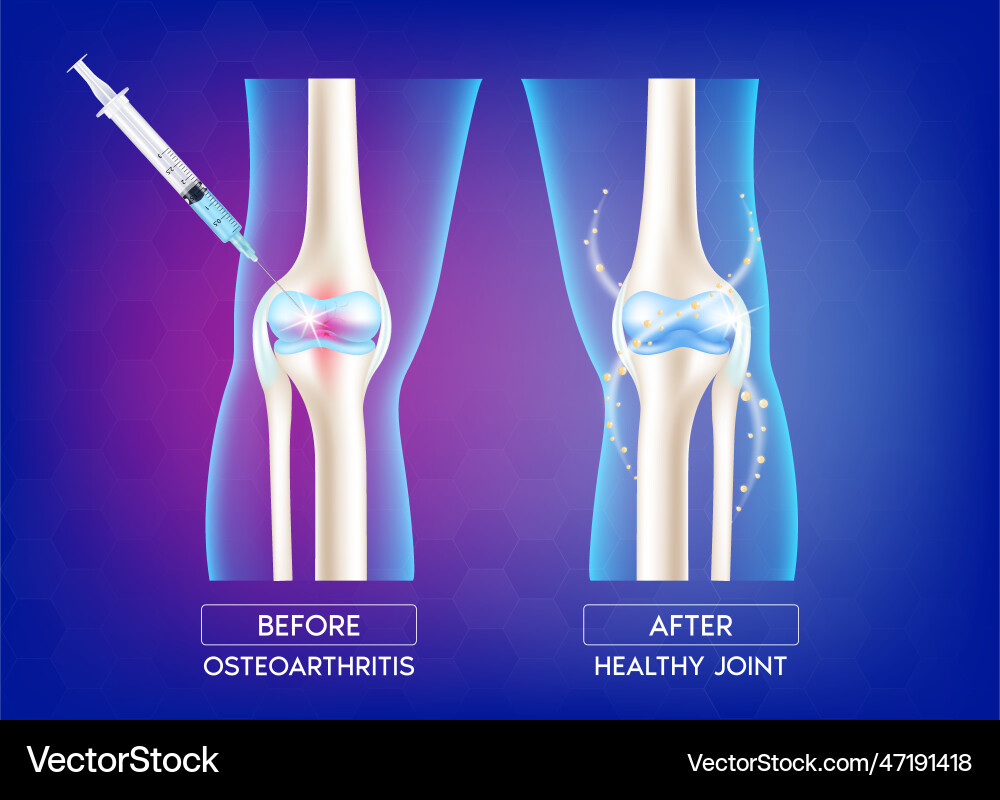 DBM Gel (Injectable, 2.5cc Syringe)
