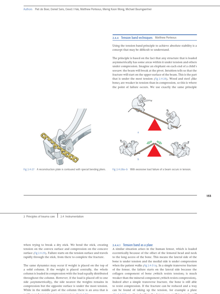 Tension Band Wiring Kit