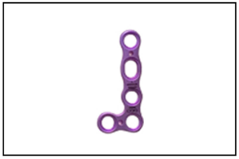 Lisfranc Midfoot Plating System