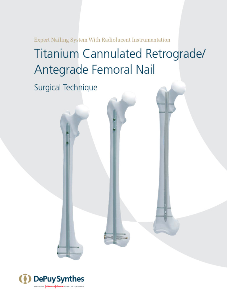 Femoral Retrograde Nail
