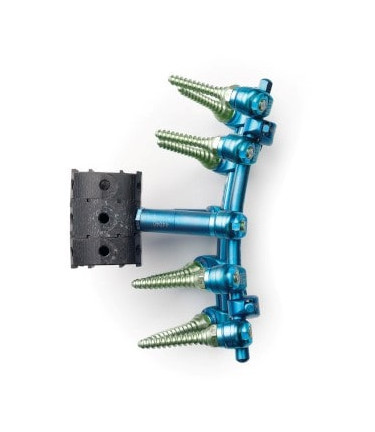 Vertebral Body Replacement (VBR) Cage