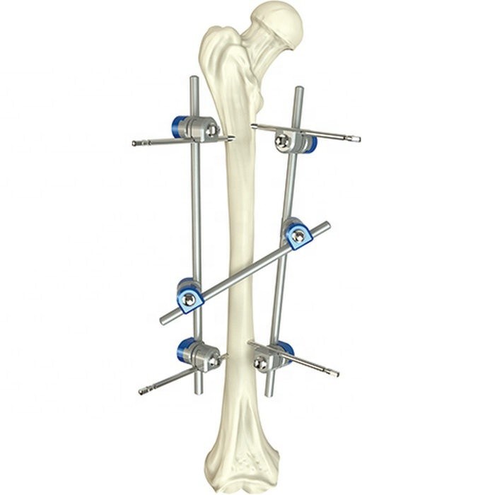 Cruciate Retaining (CR) Femoral Component