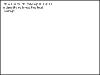 Lateral Lumbar Interbody Cage (LLIF/XLIF)