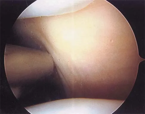Anatomy Board Review 2000: High-Yield MCQs (Set 2) - Figure 11