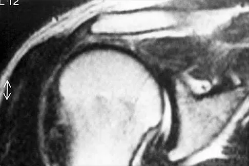 Anatomy Board Review 2000: High-Yield MCQs (Set 4) - Figure 11