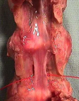 Anatomy Board Review 2000: High-Yield MCQs (Set 4) - Figure 18