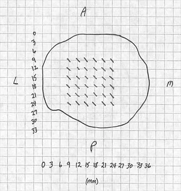 Anatomy Board Review 2000: High-Yield MCQs (Set 4) - Figure 22