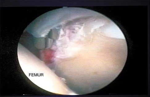Anatomy Board Review 2002: High-Yield MCQs (Set 2) - Figure 10