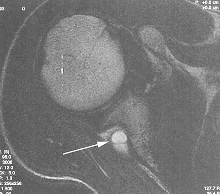 Anatomy Board Review 2002: High-Yield MCQs (Set 2) - Figure 27