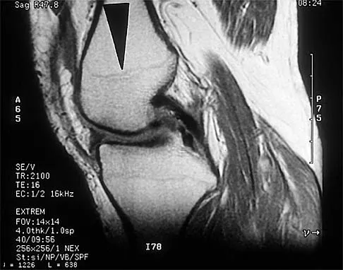 Anatomy 2002 Practice Questions: Set 3 (Solved) - Figure 21