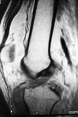 Anatomy Board Review 2002: High-Yield MCQs (Set 4) - Figure 13