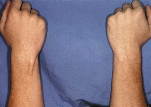 Anatomy Board Review 2002: High-Yield MCQs (Set 4) - Figure 15