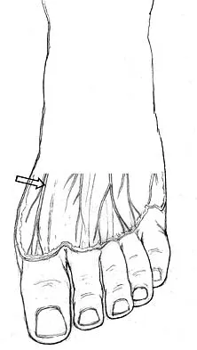 Anatomy 2005 Practice Questions: Set 1 (Solved) - Figure 21