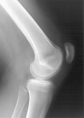 Anatomy 2005 Practice Questions: Set 1 (Solved) - Figure 28